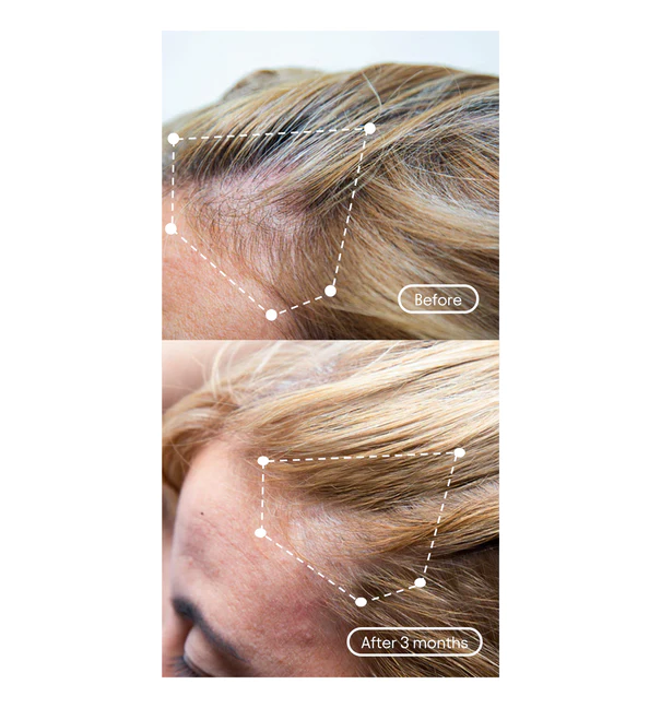 before after 1