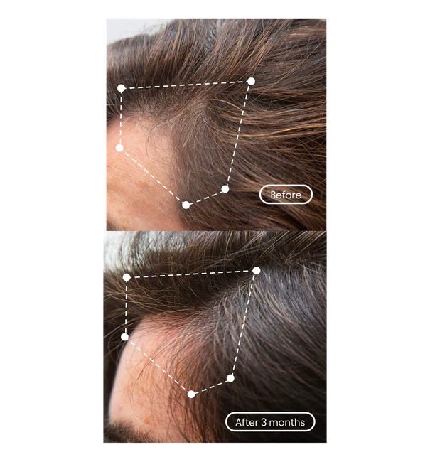 before after 2