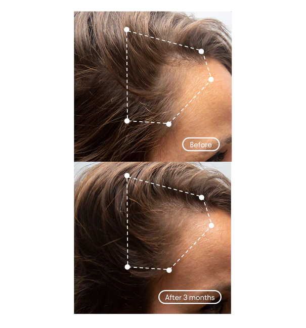before after 3 b24e0ff0 b566 4629 bf6d a5f5026d537d
